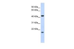 ING3 Antibody, Novus Biologicals 100 &mu;L | Buy Online | Novus Biologicals | Fisher Scientific